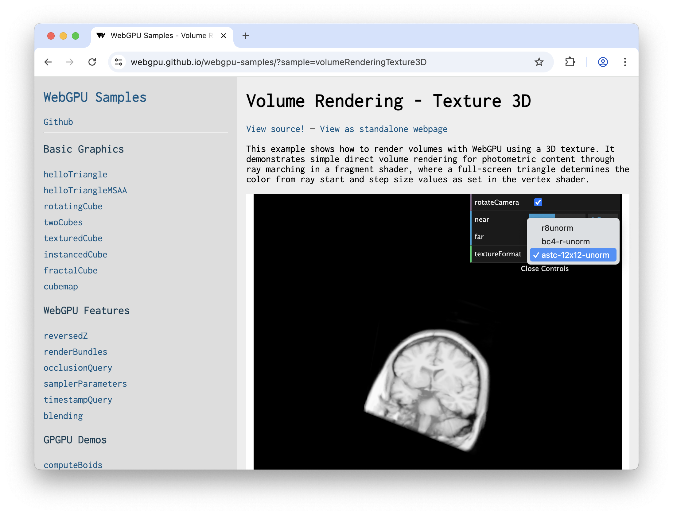 使用 WebGPU 渲染的 3D 脑部扫描图像。
